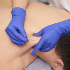 Acupuntura